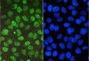 Immunofluorescent staining of FFPE human A431 cells with BCL9L antibody (green) and DAPI nuclear stain (blue). HIER: boil tissue sections in pH6, 10mM citrate buffer, for 20 min and allow to cool before testing.