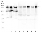 Western blot testing of 1) human HeLa, 2) human T-47D, 3) human PANC-1, 4) rat testis, 5) rat liver, 6) mouse testis, 7) mouse thymus and 8) mouse HEPA1-6 lysate with BCL9L antibody. Predicted molecular weight ~157 kDa, routinley observed at ~200 kDa.