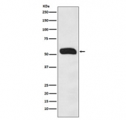 Western blot testing of human plasma lysate with Human IgG antibody. Predicted molecular weight ~50 kDa.