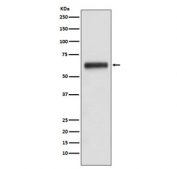 Western blot testing of human plasma lysate with Human IgG3 antibody. Predicted molecular weight ~50 kDa.