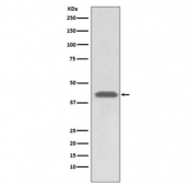 Western blot testing of human A549 cell lysate with HLA-A antibody. Predicted molecular weight ~41 kDa.