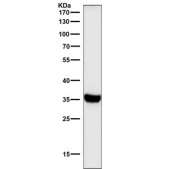 Western blot testing of human K562 cell lysate with HLA-DR antibody. Expected molecular weight ~34 kDa.