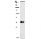 Western blot testing of human Ramos cell lysate with HLA-DR antibody. Expected molecular weight ~34 kDa.