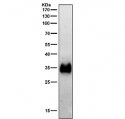 Western blot testing of rat spleen tissue lysate with HLA-DR antibody. Expected molecular weight ~34 kDa.
