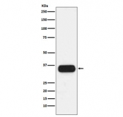 Western blot testing of human spleen lysate with HLA-DQA1 antibody. Expected molecular weight ~34 kDa.
