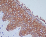 IHC staining of FFPE human skin tissue with Cytokeratin 14 antibody. HIER: boil tissue sections in pH8 EDTA for 20 min and allow to cool before testing.