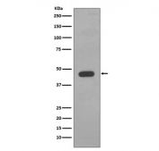 Western blot testing of human A431 cell lysate with Cytokeratin 14 antibody. Predicted molecular weight ~53 kDa.