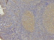 IHC staining of FFPE human tonsil with EHD1 antibody. HIER: boil tissue sections in pH6, 10mM citrate buffer, for 10-20 min and allow to cool before testing.