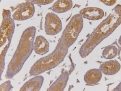 IHC staining of FFPE mouse testis with EHD1 antibody. HIER: boil tissue sections in pH6, 10mM citrate buffer, for 10-20 min and allow to cool before testing.
