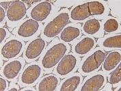 IHC staining of FFPE rat testis with EHD1 antibody. HIER: boil tissue sections in pH6, 10mM citrate buffer, for 10-20 min and allow to cool before testing.