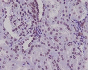 IHC staining of FFPE human kidney tissue with Lamin A/C antibody. HIER: boil tissue sections in pH6, 10mM citrate buffer, for 10-20 min and allow to cool before testing.