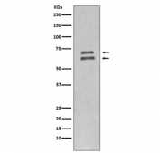 Western blot testing of human HeLa cell lysate with Lamin A/C antibody. Predicted molecular weight ~74 & 65 kDa.