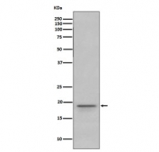 Western blot testing of human fetal brain lysate with Myelin Basic Protein antibody. Expected molecular weight: 20-37 kDa.