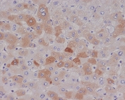 IHC staining of FFPE human liver with C Reactive Protein antibody. HIER: boil tissue sections in pH6, 10mM citrate buffer, for 10-20 min and allow to cool before testing.
