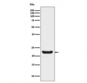 Western blot testing of human HepG2 cell lysate with RBP4 antibody. Predicted molecular weight ~23 kDa.