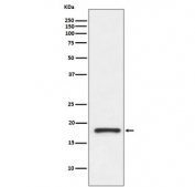 Western blot testing of human fetal kidney lysate with Prealbumin antibody. Predicted molecular weight ~16 kDa.