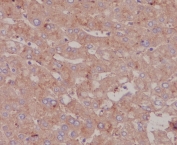 IHC staining of FFPE human liver tissue with Serum Albumin antibody. HIER: boil tissue sections in pH8 EDTA for 20 min and allow to cool before testing.
