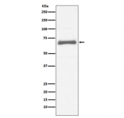 Western blot testing of human HepG2 cell lysate with AFP antibody. Predicted molecular weight ~70 kDa.