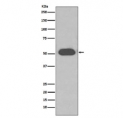 Western blot testing of human plasma lysate with VDBP antibody. Predicted molecular weight ~53 kDa.