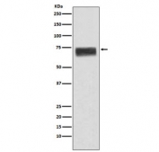 Western blot testing of human fetal liver lysate with Hemopexin antibody. Predicted molecular weight: 52-75 kDa depending on glycosylation level.