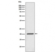 Western blot testing of human Jurkat antibody with Ferritin antibody. Predicted molecular weight ~21 kDa.