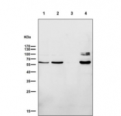 Western blot testing of human 1) HepG2, 2) SW480, 3) SK-OV-3 and 4) MCF7 cell lysate with ER alpha antibody. Predicted molecular weight ~66 kDa.