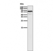Western blot testing of human K562 cell lysate with ER alpha antibody. Predicted molecular weight ~66 kDa.