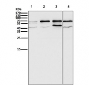 Western blot testing of human 1) 293, 2) A375, 3) MCF7 and 4) Daudi cell lysate with ER alpha antibody. Predicted molecular weight ~66 kDa.