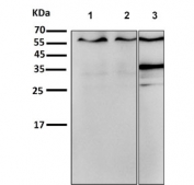 Western blot testing of 1) human HeLa, 2) human A375 and 3) rat C6 cell lysate with ER alpha antibody. Predicted molecular weight ~66 kDa.