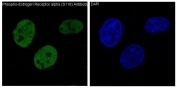 Immunofluorescent staining of FFPE human MCF7 cells with phospho-ER alpha antibody (green) and DAPI nuclear stain (blue). HIER: steam section in pH6 citrate buffer for 20 min.