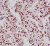 IHC staining of FFPE human kidney tissue with phospho-ER alpha antibody. HIER: boil tissue sections in pH6 citrate buffer for 20 min and allow to cool before testing.