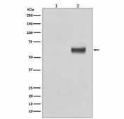 Western blot testing of human MCF7 cells 1) untreated and 2) treated with b-Estradiol and EGF, with phospho-ER alpha antibody. Predicted molecular weight ~66 kDa.