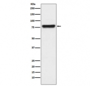 Western blot testing of human plasma lysate with Plasma Kallikrein antibody. Predicted molecular weight ~71 kDa.