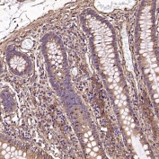 IHC staining of FFPE human colon tissue with MMP1 antibody. HIER: boil tissue sections in pH6, 10mM citrate buffer, for 10-20 min and allow to cool before testing.