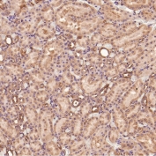 IHC staining of FFPE rat kidney tissue with MMP1 antibody. HIER: boil tissue sections in pH6, 10mM citrate buffer, for 10-20 min and allow to cool before testing.