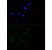 Immunofluorescent staining of FFPE human HeLa cells with MMP1 antibody (green) and DAPI nuclear stain (blue).