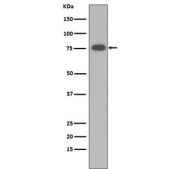 Western blot testing of the membrane fraction of human sera lysate with VTN antibody. Expected molecular weight: 54-75 kDa depending on glycosylation level.