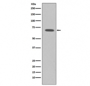 Western blot testing of human K562 cell lysate with Raf1 antibody. Predicted molecular weight ~73 kDa.