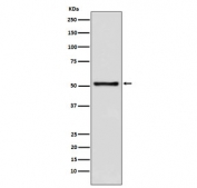 Western blot testing of human Jurkat cell lysate with TdT antibody. Predicted molecular weight ~56 kDa.