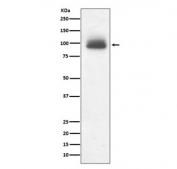 Western blot testing of human A431 cell lysate with NR3C1 antibody. Predicted molecular weight: 91-94 kDa.