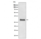 Western blot testing of human fetal brain lysate with PrP antibody. Expected molecular weight: 20-29 kDa.