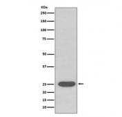 Western blot testing of rat brain with SOD2 antibody. Predicted molecular weight ~25 kDa.