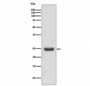 Western blot testing of human Molt4 cell lysate with TK1 antibody. Predicted molecular weight ~25 kDa.