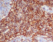 IHC staining of FFPE human tonsil tissue with CD90 antibody. HIER: boil tissue sections in pH6, 10mM citrate buffer, for 10-20 min and allow to cool before testing.