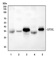 Western blot analysis using GPD1L antibody. Lane 1: human PC-3 whole cell lysates; Lane 2: human U87 whole cell lysates; Lane 3: rat heart tissue lysates; Lane 4: rat skeletal muscle tissue lysates; Lane 5: mouse heart tissue lysates. The predicted molecular weight of Glycerol-3-phosphate dehydrogenase 1-like protein is ~38 kDa, and bands are observed between ~35-40 kDa, with expected stronger expression in heart tissue.