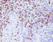 Immunohistochemistry analysis of CD3D antibody in human spleen tissue. Paraffin-embedded spleen demonstrates membranous HRP-DAB brown staining in numerous lymphocytes within periarteriolar lymphoid sheaths and surrounding white pulp regions, consistent with CD3 delta expression in mature T cells. Red pulp areas show comparatively fewer positive cells, reflecting the expected distribution of T lymphocytes. Hematoxylin counterstain highlights nuclear morphology and splenic architecture.