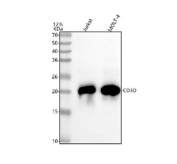 Western blot analysis of CD3D antibody in human Jurkat and MOLT-4 cell lysates. A prominent band is observed at approximately 20-22 kDa in both lanes, consistent with the predicted molecular weight of CD3 delta, which is approximately 19 kDa based on amino acid sequence. The slight upward shift in apparent molecular weight is commonly observed in SDS-PAGE and may reflect electrophoretic migration differences or post-translational modifications. Strong signal intensity in both Jurkat and MOLT-4 cells is expected due to high endogenous expression of CD3 delta in T lymphoblastic cell lines. Molecular weight markers are indicated in kDa on the left.