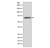 Western blot testing of human skin lysate with Keratin 1 antibody. Predicted molecular weight ~67 kDa.