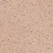 IHC staining of FFPE rat cerebral cortex tissue with S100 beta antibody. HIER: boil tissue sections in pH6, 10mM citrate buffer, for 10-20 min and allow to cool before testing.