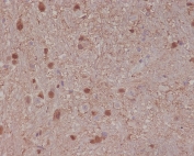 IHC staining of FFPE rat brain tissue with S100 beta antibody. HIER: boil tissue sections in pH6, 10mM citrate buffer, for 10-20 min and allow to cool before testing.